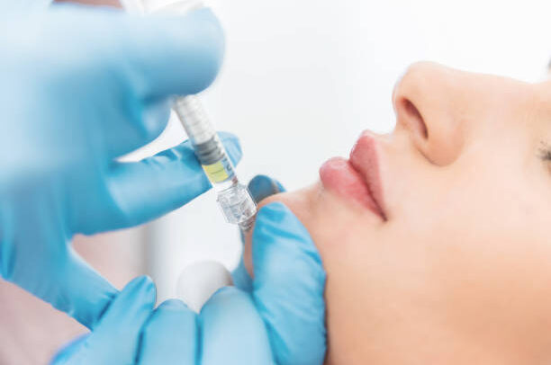 Faltenbehandlung Unterspritzung durch Hyaluronsäure Attendorn Olpe